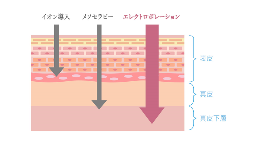 【図】イオン導入、メソセラピー、エレクトロポレーション